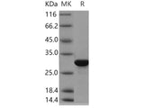 Recombinant Human BPHL Protein (His Tag)