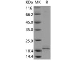 Recombinant Human PPP3R1 Protein (His Tag)(Active)