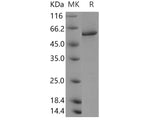 Recombinant Human PPP3CA/CALNA Protein (His Tag)(Active)