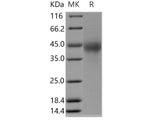 Recombinant Human TMUB2 Protein (His Tag)