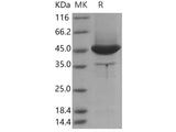 Recombinant Human MSN/Moesin Protein (aa 1-346, His Tag)