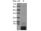 Recombinant Human GNGT1/GNG1 Protein (His Tag)