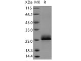 Recombinant Human Serglycin/SRGN Protein (His&Myc Tag)