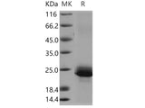 Recombinant Human Serglycin/SRGN Protein (His Tag)