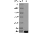 Recombinant Human PTH2/PTRH2 Protein (His Tag)