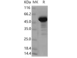 Recombinant Human NCKIPSD/SPIN90 Protein (GST Tag)