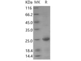 Recombinant Human BMF/Bcl2 modifying factor Protein (His Tag)