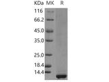 Recombinant Human CLPS/Colipase Protein (His Tag)(Active)