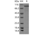 Recombinant Human PDE1C Protein (His & GST Tag)