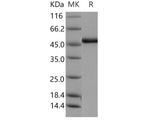 Recombinant Human ADAMTSL1/PUNCTIN Protein (His Tag)