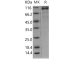 Recombinant Human ILT6/LILRA3 Protein (Fc Tag)