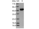 Recombinant Human Gastric intrinsic factor/GIF Protein (His Tag)