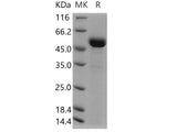 Recombinant Human ART3 Protein (His Tag)