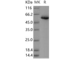 Recombinant Human CALR/Calreticulin Protein (His Tag)