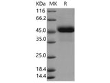 Recombinant Human Reticulocalbin 3/RCN3 Protein (aa 1-324, His Tag)