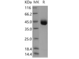 Recombinant Human IZUMO1 Protein (His Tag)