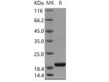 Recombinant Human SELM/Selenoprotein M Protein (His Tag)