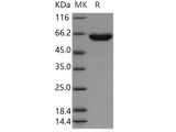 Recombinant Human TPP1/CLN2 Protein (His Tag)(Active)