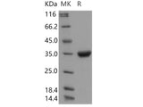 Recombinant Human IgG4-Fc Protein (108 Ser/Pro)