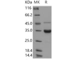 Recombinant Human IgG2-Fc Protein (257 Ser/Ala)(Active)