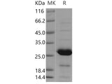 Recombinant Human PSPH Protein