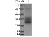 Recombinant Human SCN3B Protein (His Tag)