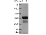 Recombinant Human DCX Protein (aa 45-150, GST Tag)