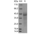 Recombinant Human GPR37 Protein (His Tag)