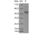 Recombinant Human APOM Protein (Fc Tag)