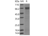 Recombinant Human SUSD4/Sushi domain-containing protein 4 Protein (Fc Tag)