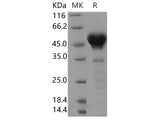 Recombinant Human Calumenin Protein (aa 1-311, His Tag)