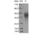 Recombinant Human B7-H5/Gi24/VSIR Protein (His tag)