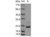 Recombinant Human Lysozyme G-like 1/LYG1 Protein (His Tag)