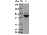 Recombinant Human Jumping Translocation Breakpoint/JTB Protein (Fc Tag)