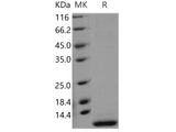 Recombinant Human SMR3B Protein (His Tag)