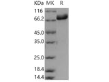 Recombinant Human DBH/Dopamine beta-Hydroxylase Protein (His Tag)