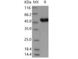 Recombinant Human CRELD1 Protein (His Tag)