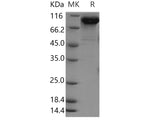 Recombinant Human FSTL5 Protein (His Tag)