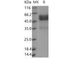 Recombinant Human TNFRSF19/TROY Protein (Fc Tag)