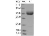 Recombinant Human LRG1 Protein