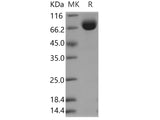 Recombinant Human LRG1 Protein (Fc Tag)