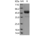 Recombinant Human Tetherin/BST2 Protein (Fc Tag)