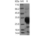 Recombinant Human PHYH Protein