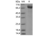 Recombinant Human TEM8/ATR Protein (Fc Tag)