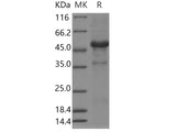 Recombinant Human LECT1 Protein (Fc Tag)