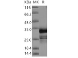 Recombinant Human CNPY4 Protein (His Tag)