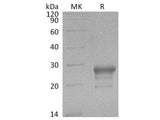 Recombinant Human PGD2 Synthase/PTGDS Protein (His Tag)