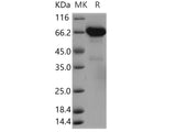 Recombinant Human ERP72/PDIA4 Protein (aa 1-641, His Tag)