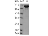 Recombinant Human ERP72/PDIA4 Protein (Fc Tag)