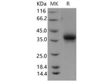 Recombinant Human EPCR Protein (His Tag)